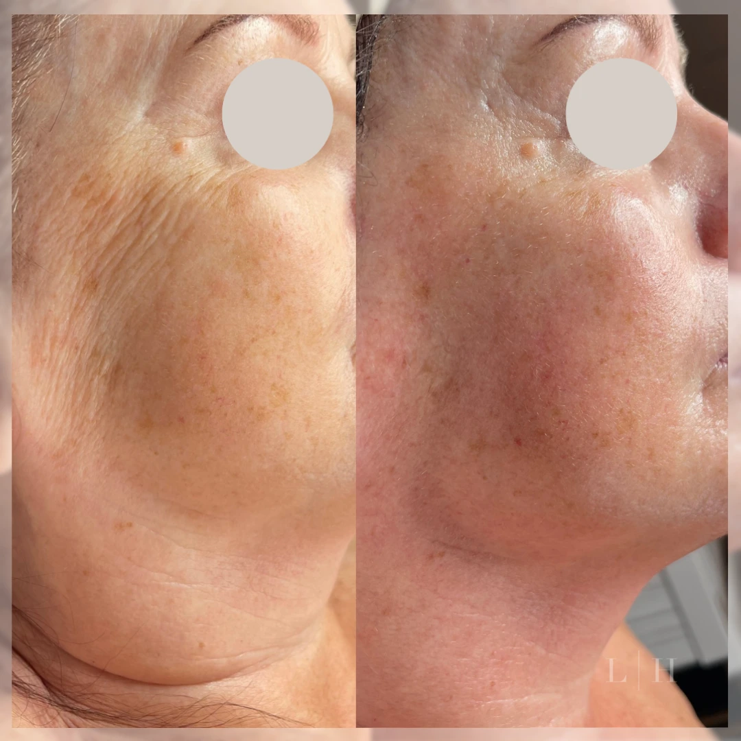 Radiance And Clarity Skin Plan